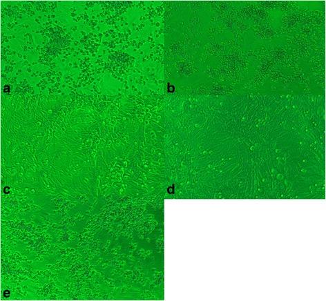 https://cdn.ncbi.nlm.nih.gov/pmc/blobs/8f54/5452404/d9a53adec35f/40249_2017_282_Fig2_HTML.jpg