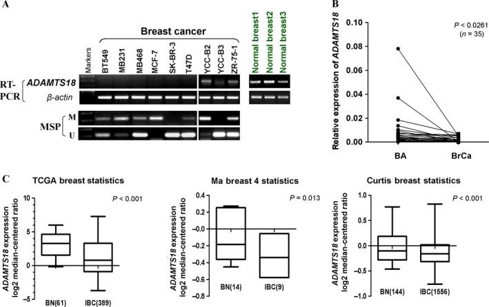 https://cdn.ncbi.nlm.nih.gov/pmc/blobs/8f54/5463072/6467d0b429e2/CAM4-6-1399-g001.jpg