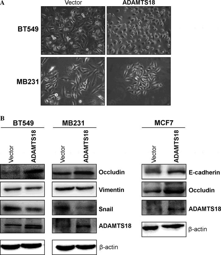 https://cdn.ncbi.nlm.nih.gov/pmc/blobs/8f54/5463072/e25266e82467/CAM4-6-1399-g005.jpg