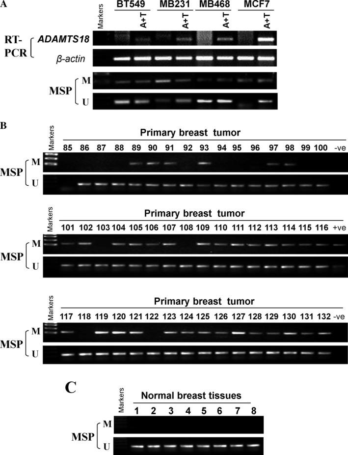 https://cdn.ncbi.nlm.nih.gov/pmc/blobs/8f54/5463072/ea52a929bf56/CAM4-6-1399-g002.jpg