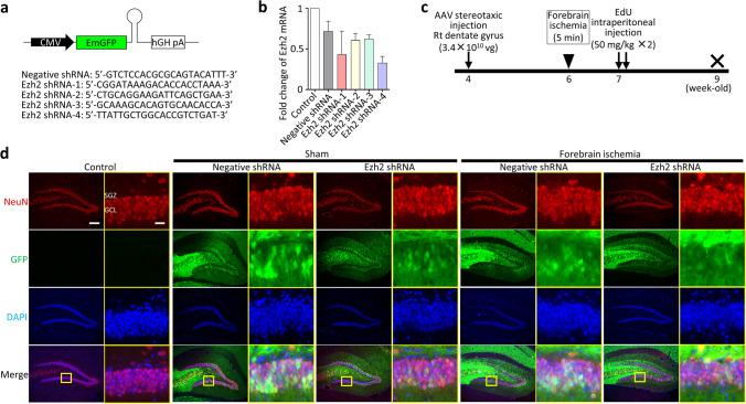 https://cdn.ncbi.nlm.nih.gov/pmc/blobs/8f5a/11496322/c5bbbd70b23a/12035_2024_4200_Fig1_HTML.jpg