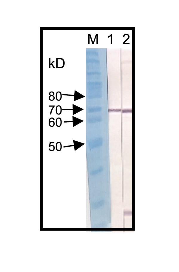 https://cdn.ncbi.nlm.nih.gov/pmc/blobs/8f5e/449723/e46dbd5f1b91/1475-2875-3-16-3.jpg