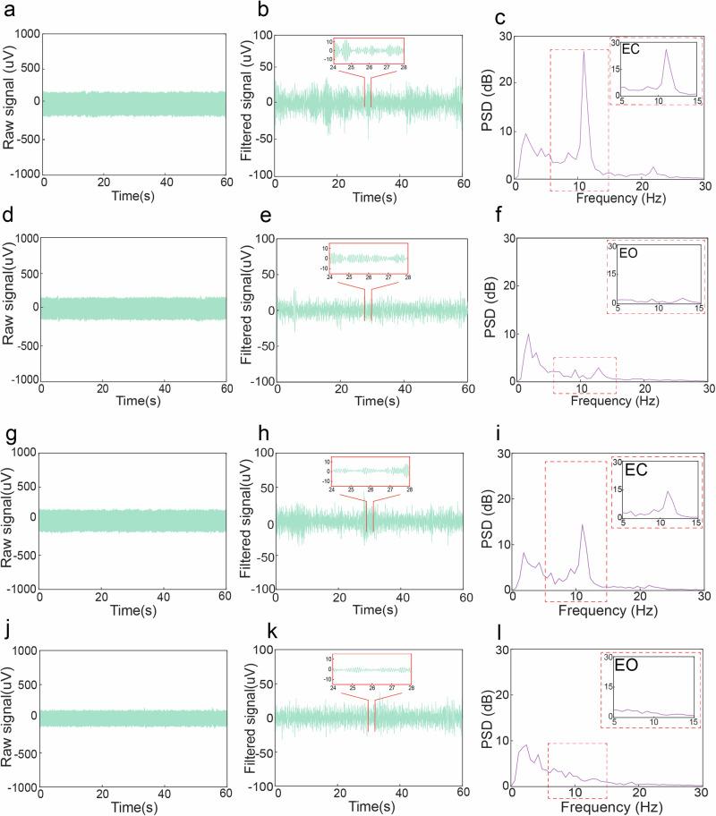 https://cdn.ncbi.nlm.nih.gov/pmc/blobs/8f64/11931732/ef26c58661ee/44385_2025_9_Fig4_HTML.jpg