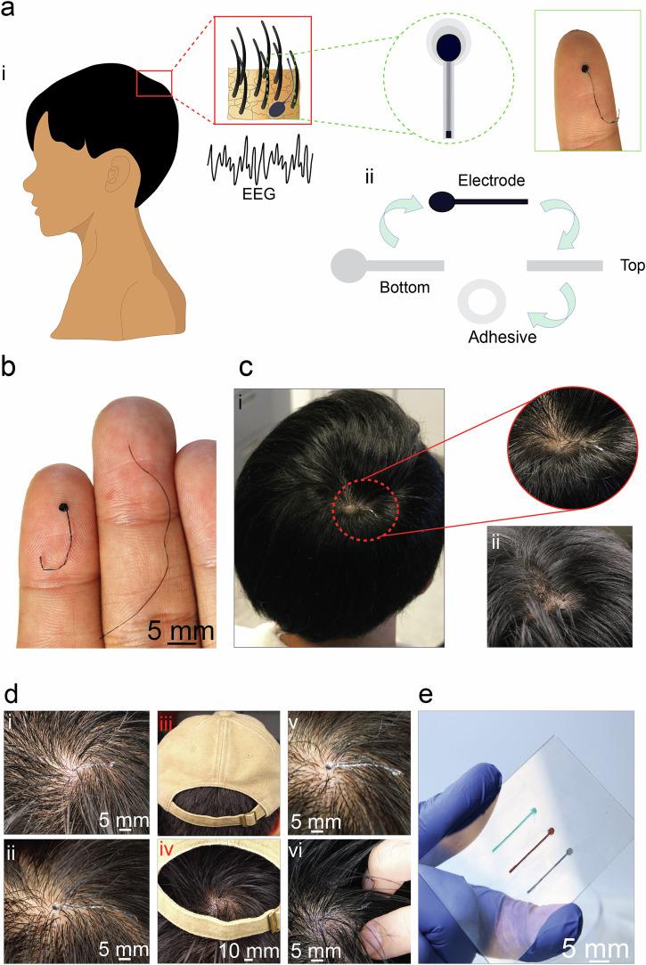https://cdn.ncbi.nlm.nih.gov/pmc/blobs/8f64/11931732/f9b9e9db9044/44385_2025_9_Fig1_HTML.jpg
