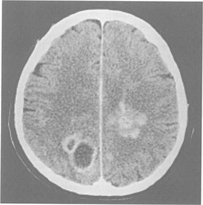 https://cdn.ncbi.nlm.nih.gov/pmc/blobs/8f6a/1073081/205a79d9c3c6/jnnpsyc00038-0079-c.jpg
