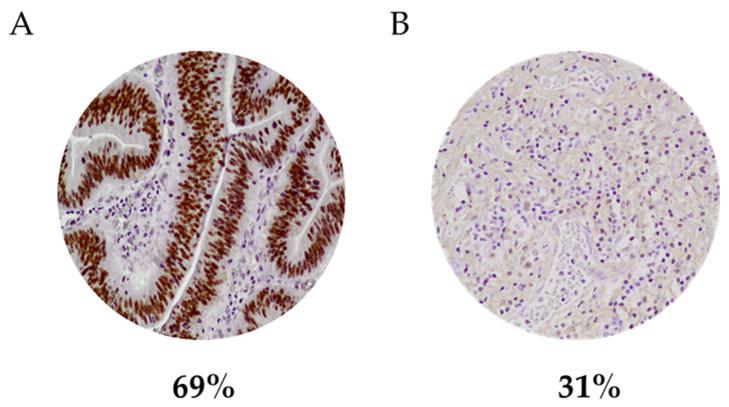 https://cdn.ncbi.nlm.nih.gov/pmc/blobs/8f6a/8774981/59fa80724d58/curroncol-29-00005-g001.jpg