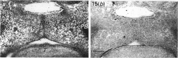 https://cdn.ncbi.nlm.nih.gov/pmc/blobs/8f6d/1259718/10fac8b19d63/janat00148-0051-b.jpg
