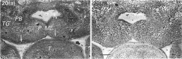 https://cdn.ncbi.nlm.nih.gov/pmc/blobs/8f6d/1259718/21dadb9a85f5/janat00148-0053-a.jpg