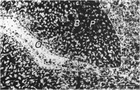 https://cdn.ncbi.nlm.nih.gov/pmc/blobs/8f6d/1259718/69017faa3e88/janat00148-0052-b.jpg