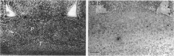 https://cdn.ncbi.nlm.nih.gov/pmc/blobs/8f6d/1259718/737990cd5da8/janat00148-0050-b.jpg