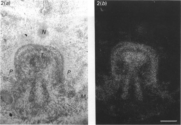 https://cdn.ncbi.nlm.nih.gov/pmc/blobs/8f6d/1259718/eb2a122b6a02/janat00148-0043-a.jpg