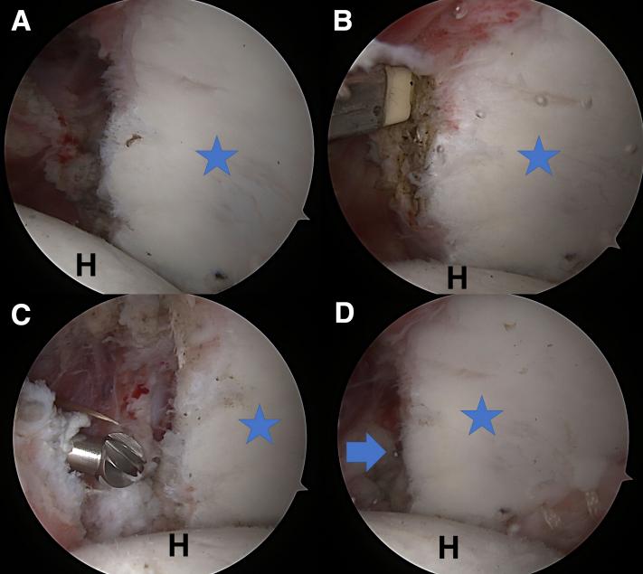 https://cdn.ncbi.nlm.nih.gov/pmc/blobs/8f6f/7917087/78572dd1f3da/gr3.jpg