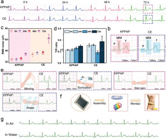 https://cdn.ncbi.nlm.nih.gov/pmc/blobs/8f71/10767437/c7b5d87e69e8/ADVS-11-2304871-g002.jpg