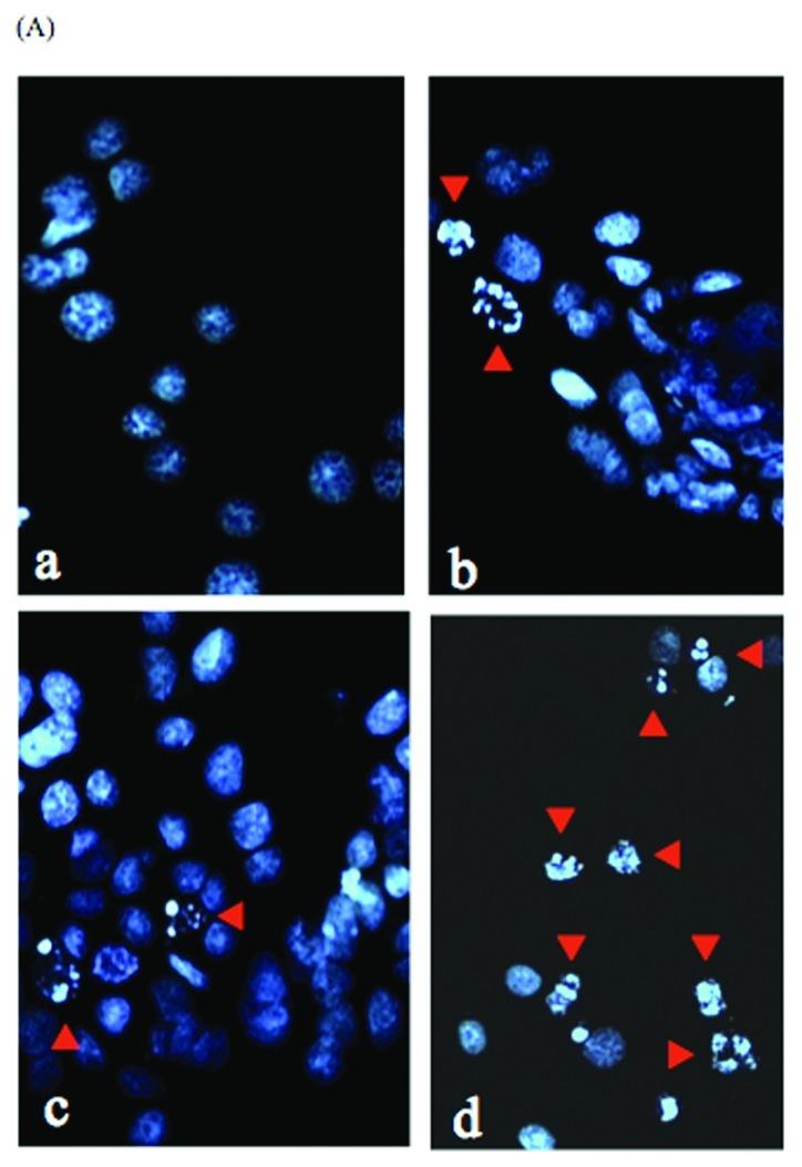 https://cdn.ncbi.nlm.nih.gov/pmc/blobs/8f78/3583629/5ca4a5d69f1f/IJO-42-01-0075-g07.jpg