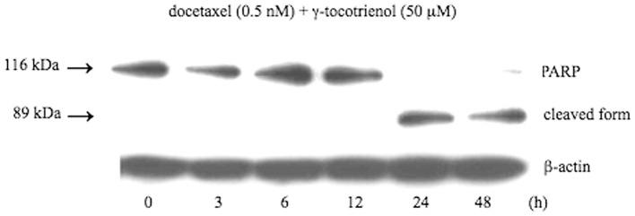 https://cdn.ncbi.nlm.nih.gov/pmc/blobs/8f78/3583629/ad1362b7ee6a/IJO-42-01-0075-g06.jpg