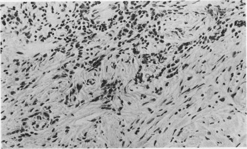 https://cdn.ncbi.nlm.nih.gov/pmc/blobs/8f7d/476724/e27469f841dc/jclinpath00171-0091-b.jpg