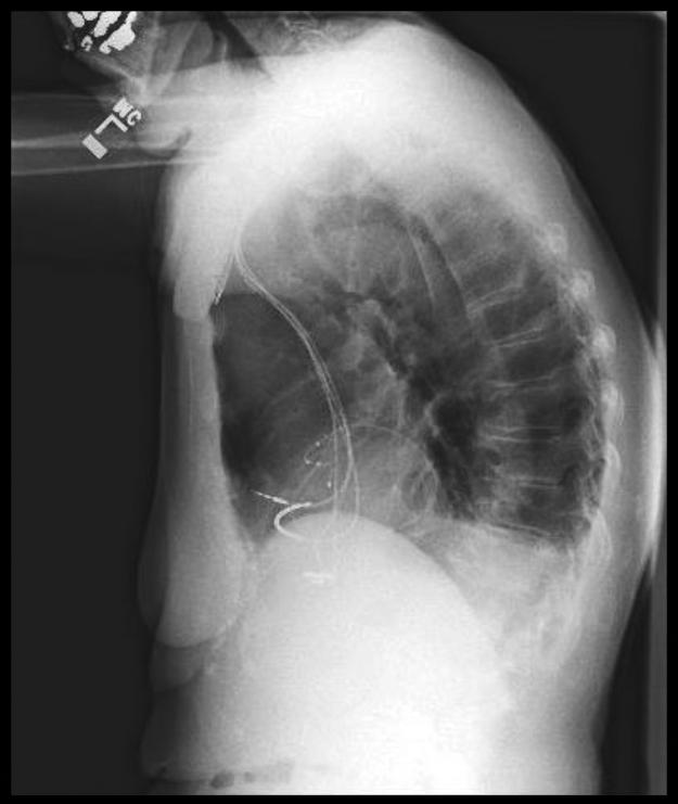 https://cdn.ncbi.nlm.nih.gov/pmc/blobs/8f81/5420027/9749e53b96dc/gr2.jpg