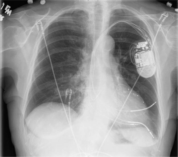 https://cdn.ncbi.nlm.nih.gov/pmc/blobs/8f81/5420027/f9821e5b2706/gr1.jpg
