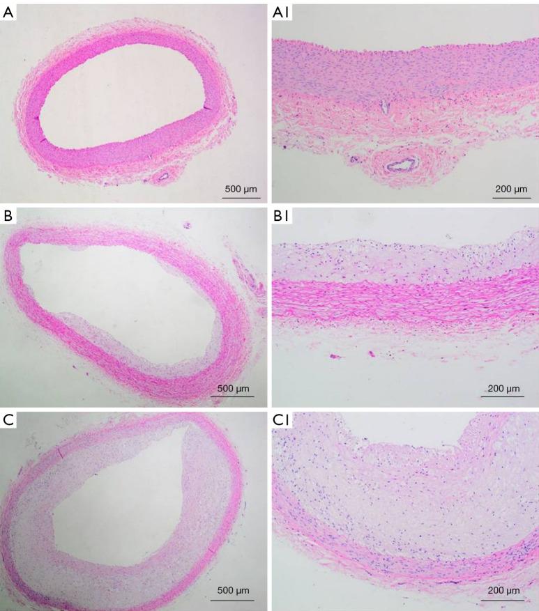 https://cdn.ncbi.nlm.nih.gov/pmc/blobs/8f89/9201133/46a7d98b497f/atm-10-10-569-f2.jpg