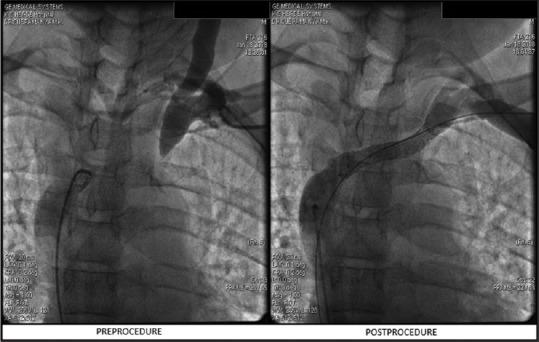 https://cdn.ncbi.nlm.nih.gov/pmc/blobs/8f8a/7869648/eef21b46ecce/IJN-30-337-g001.jpg