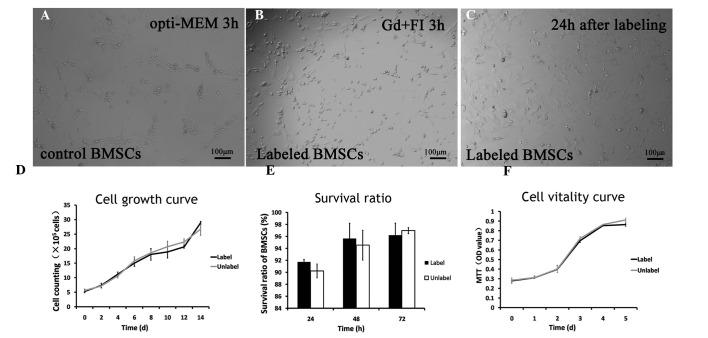 https://cdn.ncbi.nlm.nih.gov/pmc/blobs/8f8b/4438951/c6342e8a86b3/MMR-12-01-0913-g02.jpg