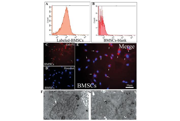 https://cdn.ncbi.nlm.nih.gov/pmc/blobs/8f8b/4438951/dc8a09ab94c1/MMR-12-01-0913-g01.jpg