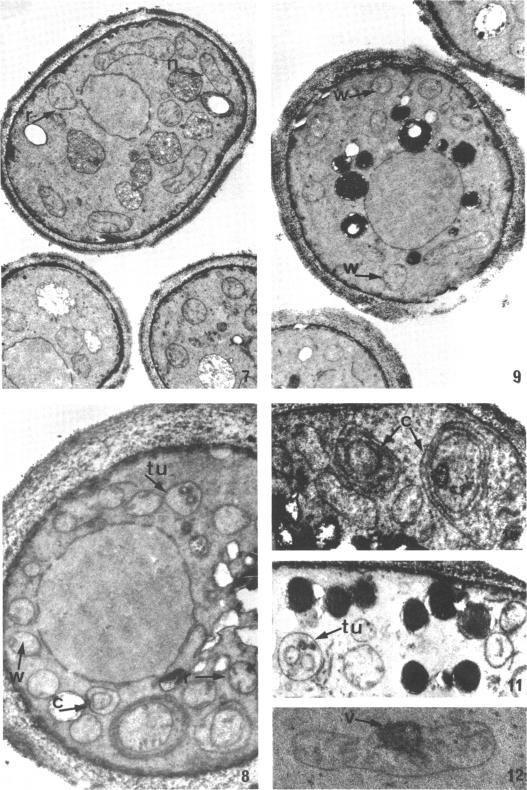 https://cdn.ncbi.nlm.nih.gov/pmc/blobs/8f8f/248233/3375b3a88c36/jbacter00376-0518-a.jpg