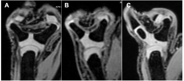 https://cdn.ncbi.nlm.nih.gov/pmc/blobs/8f93/8887608/efa7b8d4da76/IJGM-15-2163-g0003.jpg