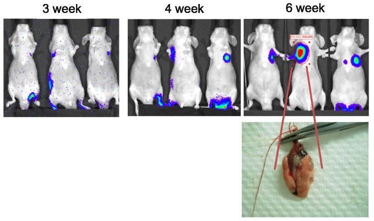 https://cdn.ncbi.nlm.nih.gov/pmc/blobs/8f98/5228536/aafd65bc2c4f/etm-12-06-3614-g04.jpg