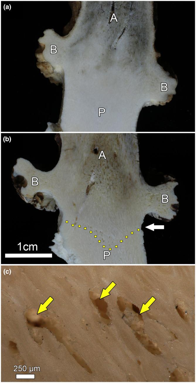 https://cdn.ncbi.nlm.nih.gov/pmc/blobs/8f9b/10557394/048b3e35b470/JOA-243-842-g010.jpg