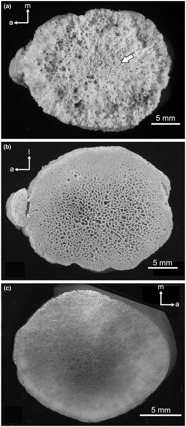 https://cdn.ncbi.nlm.nih.gov/pmc/blobs/8f9b/10557394/5a6eb3e51f45/JOA-243-842-g009.jpg