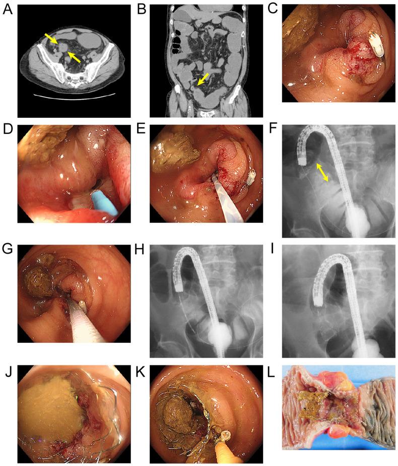 https://cdn.ncbi.nlm.nih.gov/pmc/blobs/8fa0/7890458/93851c989ad3/mco-14-04-02225-g01.jpg