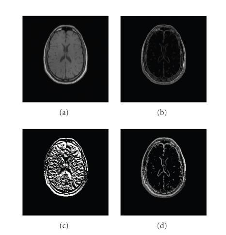 https://cdn.ncbi.nlm.nih.gov/pmc/blobs/8fa1/1934945/7d429ef02b3b/IJBI2007-93479.002.jpg