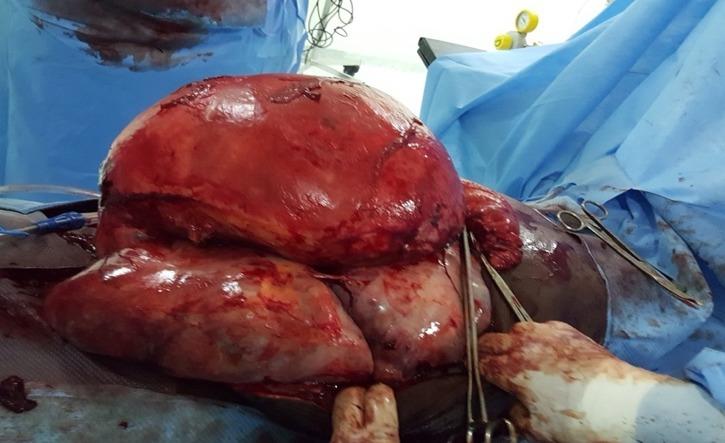 https://cdn.ncbi.nlm.nih.gov/pmc/blobs/8faa/6488250/14183357aea1/PAMJ-31-151-g002.jpg