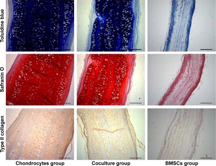 https://cdn.ncbi.nlm.nih.gov/pmc/blobs/8fab/4370944/09894b6f4b40/ijn-10-2089Fig5.jpg