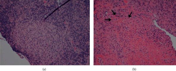 https://cdn.ncbi.nlm.nih.gov/pmc/blobs/8fab/7886506/5a1b9fde42c3/GRP2021-8167149.010.jpg