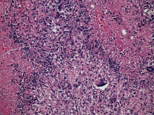 https://cdn.ncbi.nlm.nih.gov/pmc/blobs/8fab/7886506/6e3fd229df54/GRP2021-8167149.009.jpg