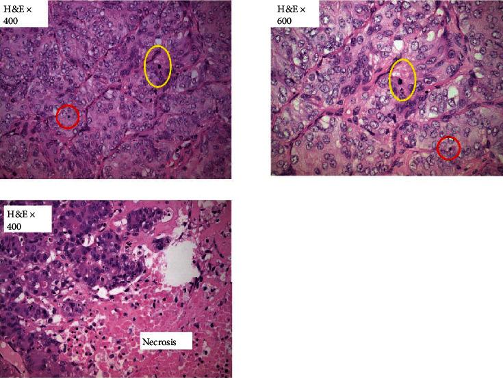 https://cdn.ncbi.nlm.nih.gov/pmc/blobs/8faf/7714602/09b472932868/CRIOG2020-8896070.002.jpg