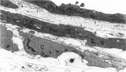 https://cdn.ncbi.nlm.nih.gov/pmc/blobs/8fc4/2001805/5dca1f964c02/ijexpath00009-0084-a.jpg