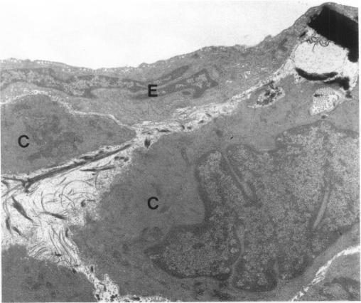 https://cdn.ncbi.nlm.nih.gov/pmc/blobs/8fc4/2001805/9d8389490798/ijexpath00009-0083-a.jpg