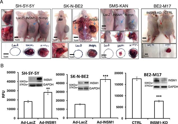 https://cdn.ncbi.nlm.nih.gov/pmc/blobs/8fc8/4742205/01f2ba0ed862/oncotarget-06-36700-g006.jpg
