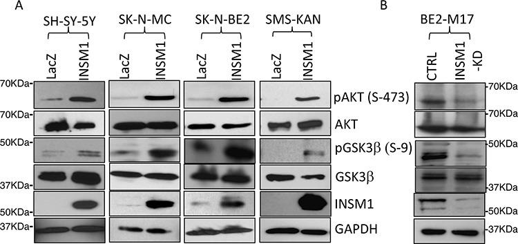 https://cdn.ncbi.nlm.nih.gov/pmc/blobs/8fc8/4742205/8686e360e7bb/oncotarget-06-36700-g003.jpg