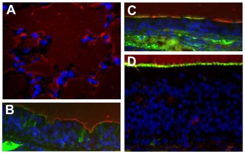 https://cdn.ncbi.nlm.nih.gov/pmc/blobs/8fcc/2791199/dee0891c770f/ppat.1000709.g008.jpg