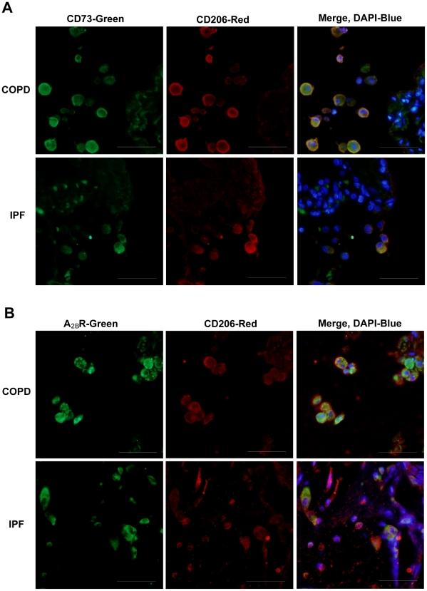 https://cdn.ncbi.nlm.nih.gov/pmc/blobs/8fd1/2821921/19e380b8ad26/pone.0009224.g007.jpg