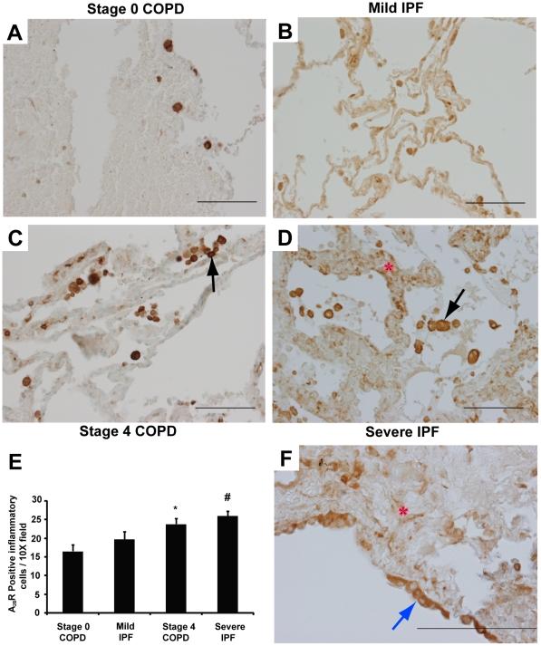 https://cdn.ncbi.nlm.nih.gov/pmc/blobs/8fd1/2821921/d70ffd460cd8/pone.0009224.g006.jpg