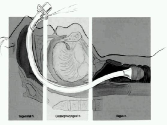 https://cdn.ncbi.nlm.nih.gov/pmc/blobs/8fd1/2900072/6967f9b087a2/IJA-53-641-g001.jpg
