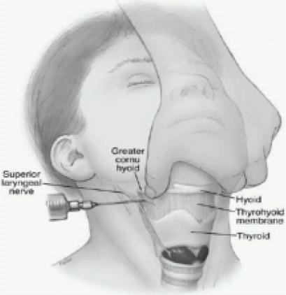 https://cdn.ncbi.nlm.nih.gov/pmc/blobs/8fd1/2900072/adc807a683c2/IJA-53-641-g008.jpg