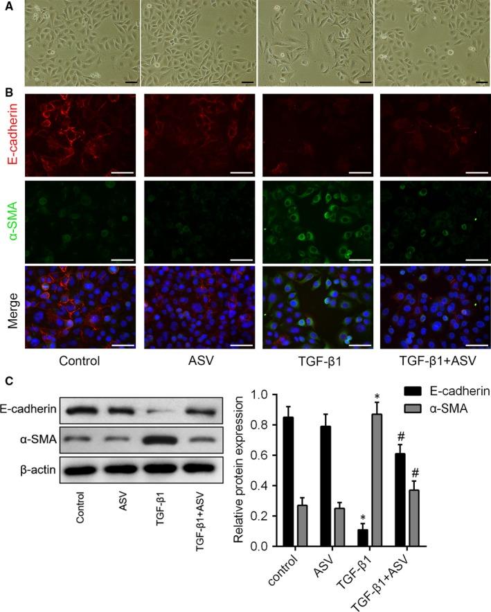 https://cdn.ncbi.nlm.nih.gov/pmc/blobs/8fd2/6111865/57ad588df71f/JCMM-22-4354-g005.jpg