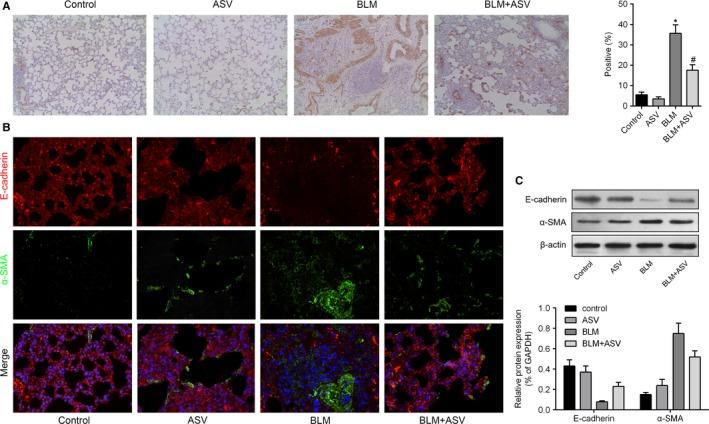 https://cdn.ncbi.nlm.nih.gov/pmc/blobs/8fd2/6111865/8a62ee2a4aa3/JCMM-22-4354-g003.jpg