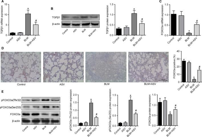 https://cdn.ncbi.nlm.nih.gov/pmc/blobs/8fd2/6111865/8c15530c69fb/JCMM-22-4354-g004.jpg